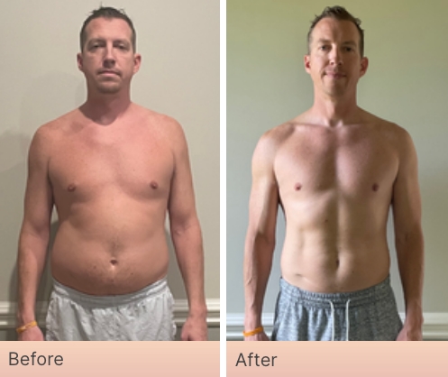 Before and After Real Result pictures of a person who has used the NeoraFit System - 6